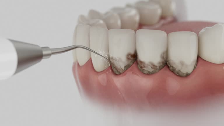 Reliable Dental contractor in Lumberton, TX by Smile Center Dentistry